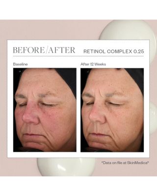 Retinol Complex 0.25 1 oz.