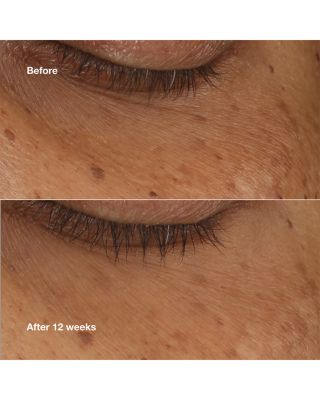 All About Eyes Brightening Serum Concentrate 0.34 oz.