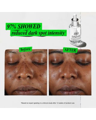 Radiance Revival Skincare Gift Set ($104 value)