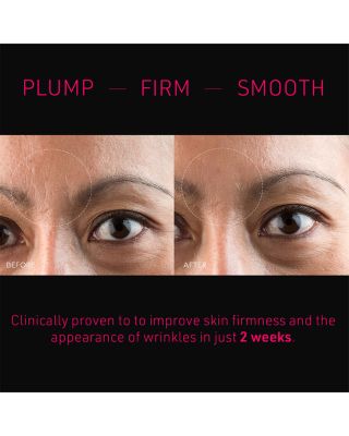 FAQ™ Microneedling Hyaluronic Acid Patches for Forehead, Pack of 3