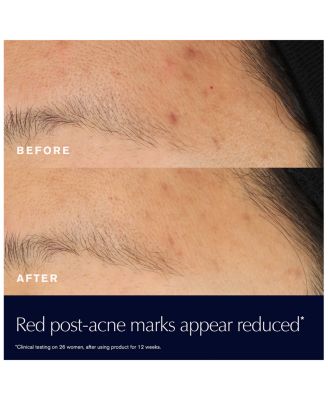 Advanced Night Repair Rescue Solution Serum with 15% Bifidus Ferment 0.68 oz.