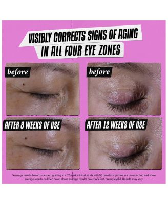 Super Multi-Corrective Eye Zone Treatment 0.9 oz.