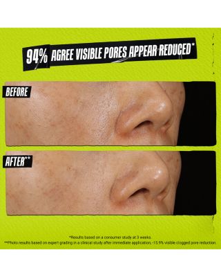 Rare Earth Clay Face Mask for Pores & Uneven Texture 4.2 oz.