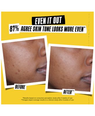 Better Screen™ UV Serum 1.7 oz.