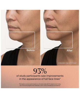 The Radiant Renewal TheraFace Depuffing Wand & Mask Gift Set