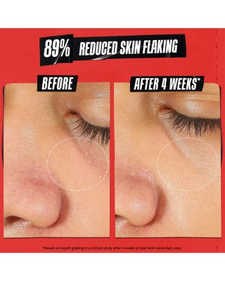 Ultra Facial Meltdown Recovery Medicated Cream with Colloidal Oatmeal 1.7 oz.