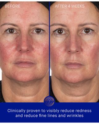 The Hydrogel Face Mask, Pack of 3