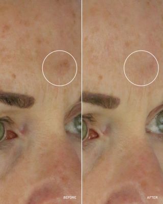 NAD+ Cell Energizing Treatment 1.7 oz.