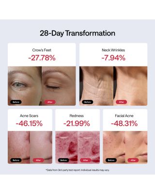 JMOON Flexglow Light Therapy Device