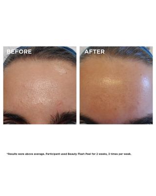 Beauty Flash Peel with BHA & AHA 1.7 oz.