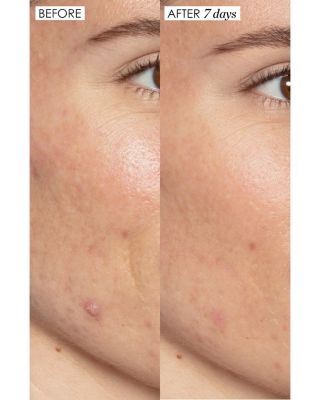 Jewel Box Gift Set ($64 value)