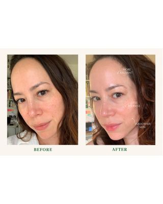 Superkind Essentials Sensitive Skin Routine ($155 value)