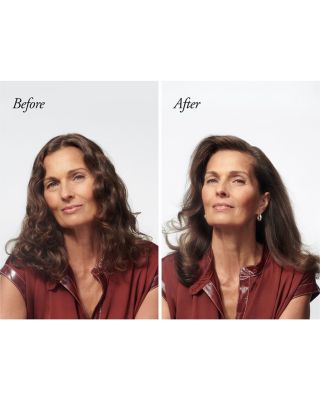 Serene Scalp Thickening Treatment Spray 4.2 oz.