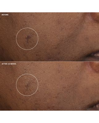 Even Better Clinical Brightening Moisturizer 0.5 oz.