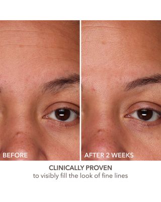 DermInfusions Fill + Repair Serum 1 oz.