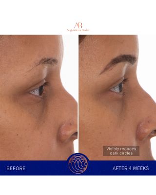 The Eye Patches, Pack of 6