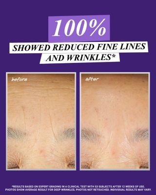 Retinol Skin-Renewing Daily Micro-Dose Serum 1.7 oz.