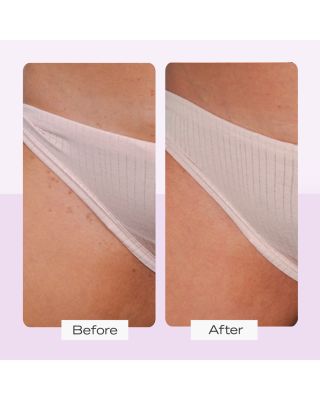 Ingrown Hair Pads with BHA & AHA