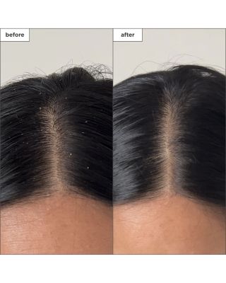 Scalp Revival Charcoal + Tea Tree Buildup Detox Spray 4 oz.