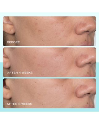 Dark Spot Serum with Niacinamide 1 oz.