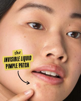 Truly Targeted Acne Clearing Solution with Salicylic Acid 0.5 oz.