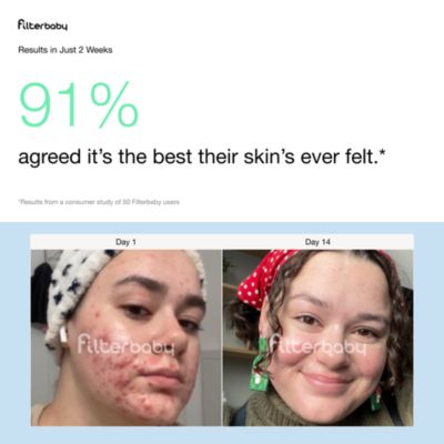 Skincare Filter 2