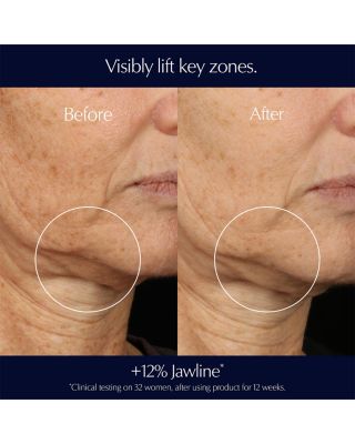 Perfectionist Pro Rapid Firm + Lift Serum Duo ($270 value)