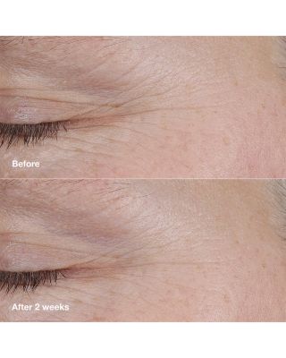 Smart Clinical Repair™ AM/PM Retinoid Balm