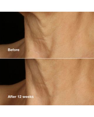 Smart Clinical Repair™ Lifting Face + Neck Cream 1.7 oz.