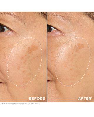 Bright Plus [Advanced] Brightening Dark Spot Targeting Expert Serum 1 oz.