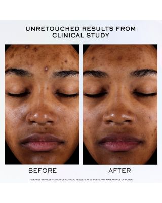 Clarifique Pro Solution Brightening & Dark Spot Reducing Serum 1.7 oz.