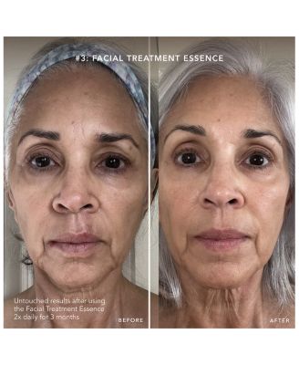 PITERA™ Anti-Aging Gift Set ($424 value)