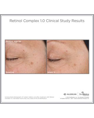 Retinol Complex 1.0 1 oz.
