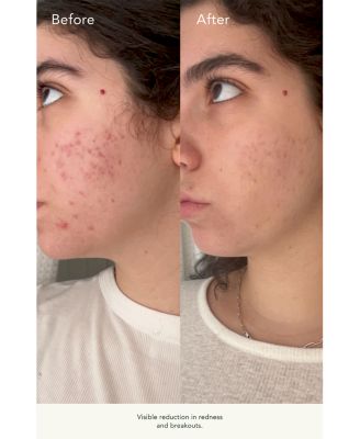 Vitabiome™ Active Skin Optimizer 3.4 oz.