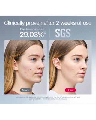 ReGlow LED Light Therapy Mask