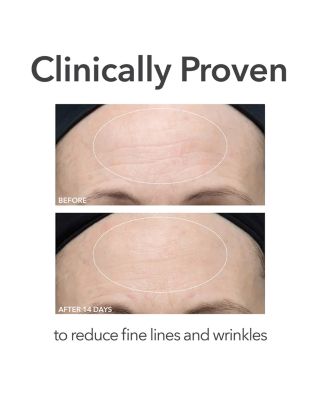 Alpha Beta Ultra Gentle Daily Peel