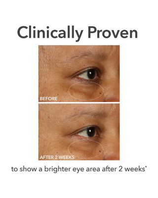 DermInfusions Fill + Repair Eye Cream 0.5 oz.