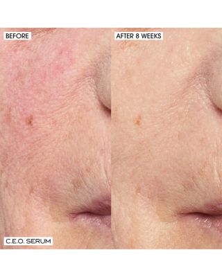 C.E.O. Home + Away Set ($135 value)