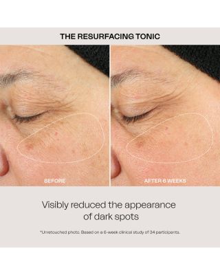 Resurfacing Tonic 3.3 oz.