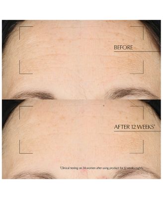 Advanced Night Repair Overnight Treatment 2 oz.