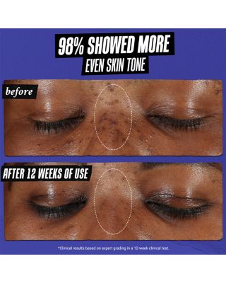 Clearly Corrective™ Dark Spot Solution 1.7 oz.