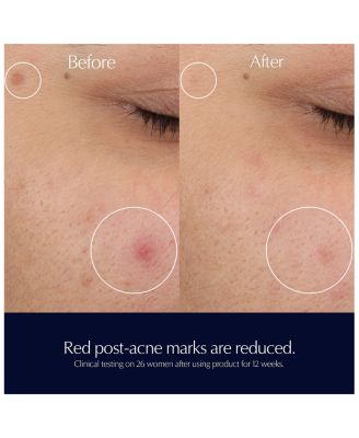 Advanced Night Repair Rescue Solution Serum with 15% Bifidus Ferment 0.68 oz.