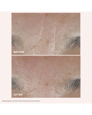 Face & Eyes Skincare Gift Set ($190 value)