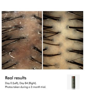 Amino Leave-in Scalp Bubble Treatment, 75mL