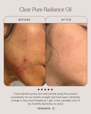 Clear Pure Radiance Oil 1 oz.