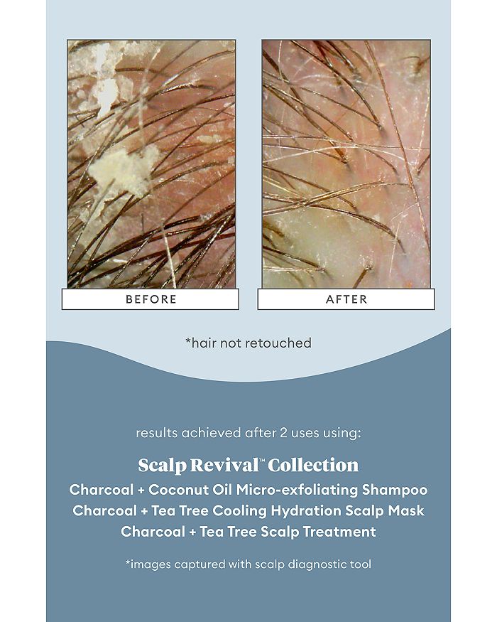 Shop Briogeo Scalp Revival Charcoal + Coconut Oil Micro-exfoliating Shampoo 2 Oz.