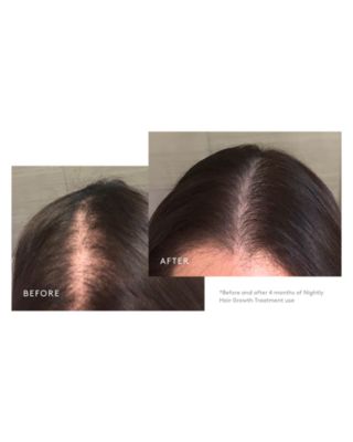 Flourish Nightly Intensive Hair Growth Treatment - 90 Days