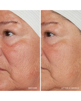 Redness Relief Intense with Manuka Honey 1.7 oz.