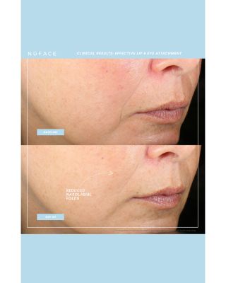 Effective Lip & Eye Trinity+ Attachment