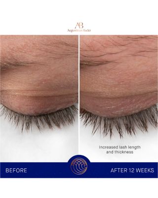 The Eyebrow & Lash Enhancing Serum